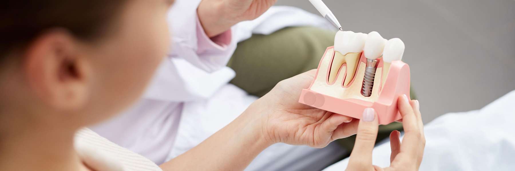 Dental Implants | Dentist