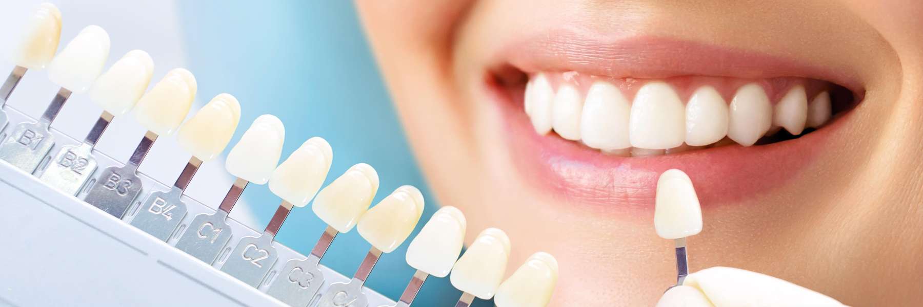 Teeth Whitening | Dentist