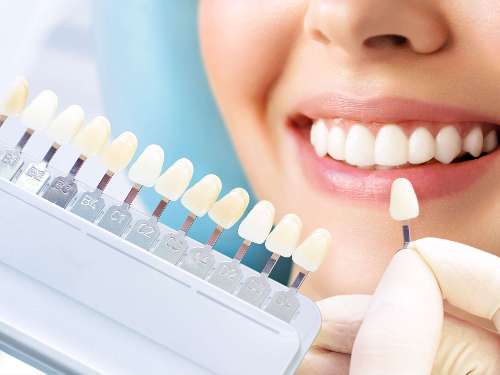 In Chair Teeth Whitening